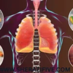 Pneumonia